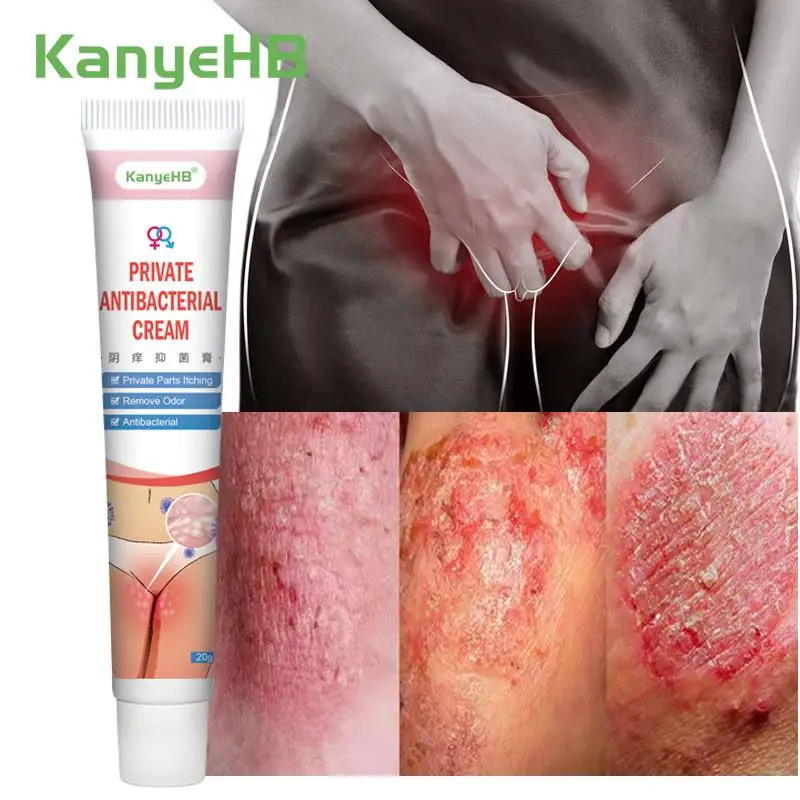 

1Pcs Private Part Antibacterial Cream Eczema Dermatitis Treatment Ointment Remove Genital Odor Relieve Itch Herbal Plaster G007