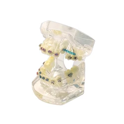 Dental Restoration and Orthodontics Teaching Display Model (M3005 - 03)