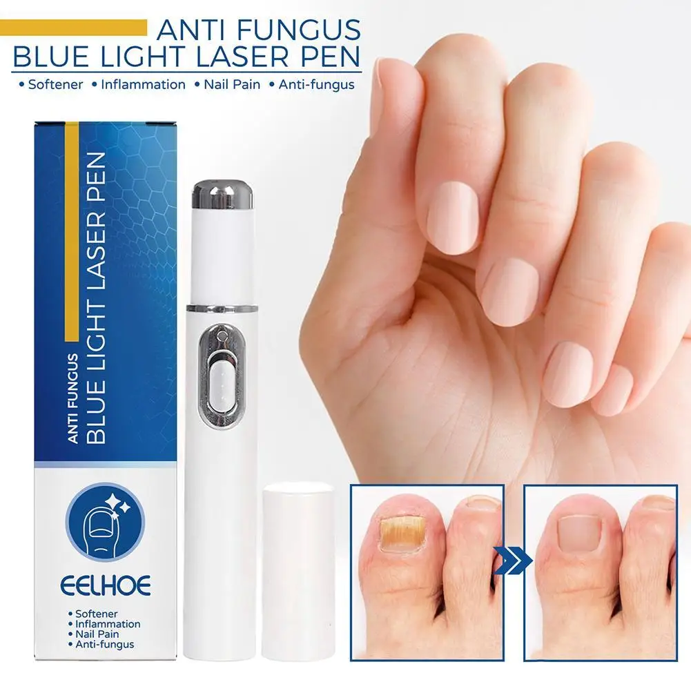 Nail Fungus Treatment Pen Anti-fungal Repair Pen Blue Light Laser Paronychia Nail Onychomycosis Painless Removal Care Tool