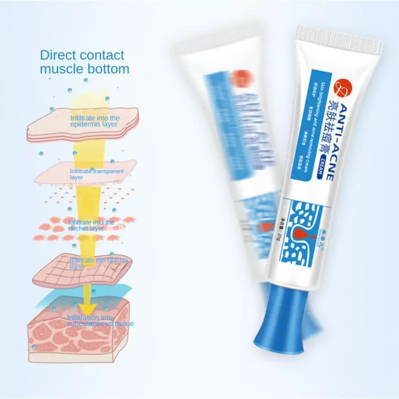 25g Acne Removal Face Cream Natural Acne Beauty Health Anti-acne Gel Pimple Spot Removal Skin Care Mild