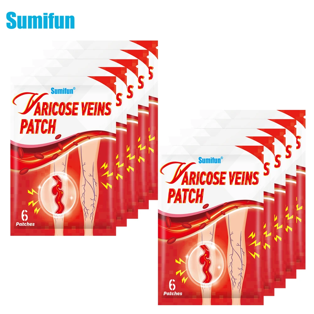 

60pcs Sumifun Varicose Veins Patch Vasculitis Phlebitis Spider Varicosity Angiitis Stickers Removal Herbal Medical Plaster