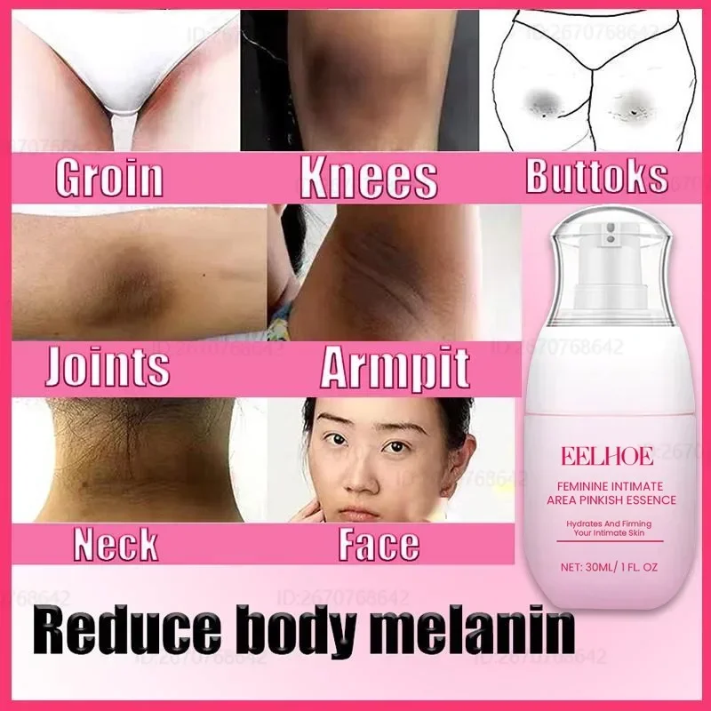 Inner Thigh Brightening Cream Private Parts Lighten Cream Intimate Area Armpit Knee Bleach Emulsion Underarm Brighten Skin Care 3
