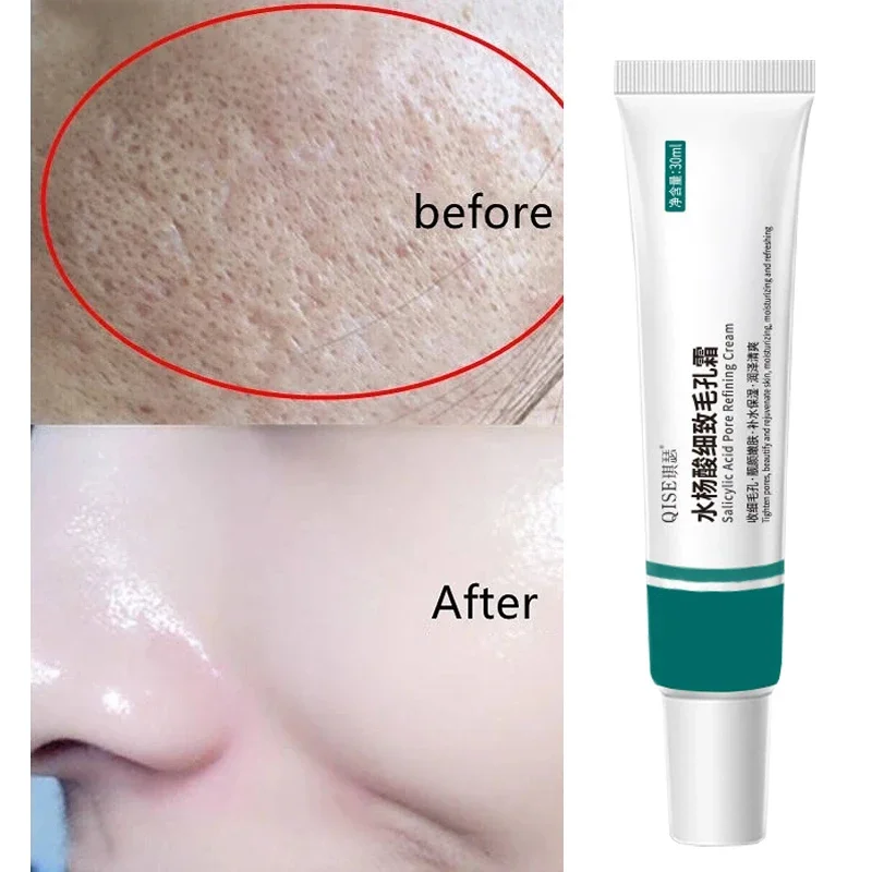 Salicylic Acid Pore Shrinking Face Cream Large Pores Tightening Repairing Serum Moisturizing Oil Control Skincare Women Makeup