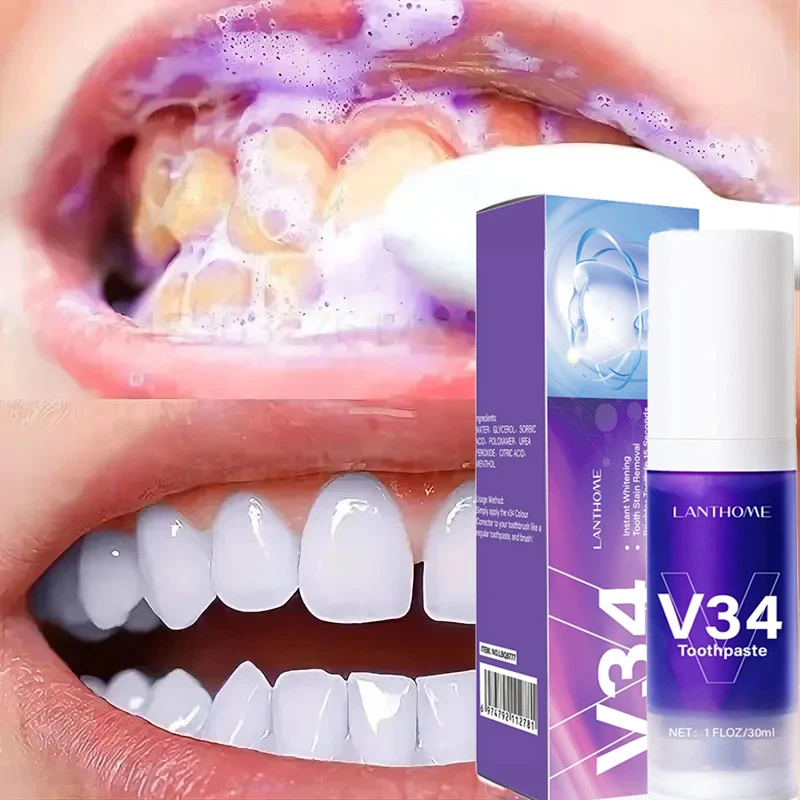 Teeth Whitening Gel Pen Color Corrector Toothpaste Plaque Stains Remover Oral Hygiene Cleaning Dental Tool Tooth Care Purple teeth whitening product teeth health product