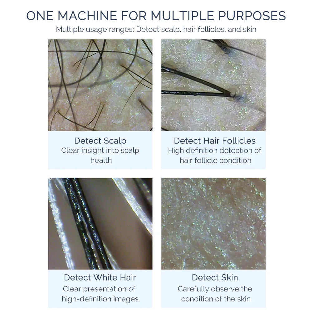 Portable Hair Follicle Scalp Detector 50X/200X Magnifying Pore Magnifier Mini Skin And Hair Eetector Skin Analyzer Skin Tester