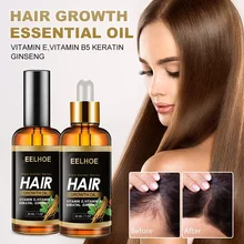 

30ml Hair Growth Essential Oil Prevent Hair Loss Thinning Hair Repair Damaged Hair Nourishing Repair Scalp Serum Hair Care