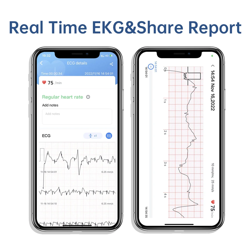 CheckMe DuoEK S Bluetooth Portable Data Recording ECG Monitor Without metal Electrodes Home Use EKG Monitoring