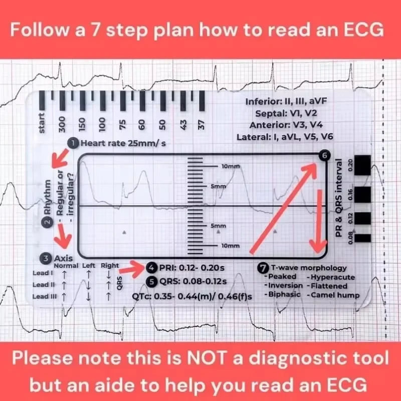 Ecg 7 Step Ruler 7 Step Scale for Ecg Observation Portable Transparent 7step Ruler Measurement Tool for Interpretation measurement tool