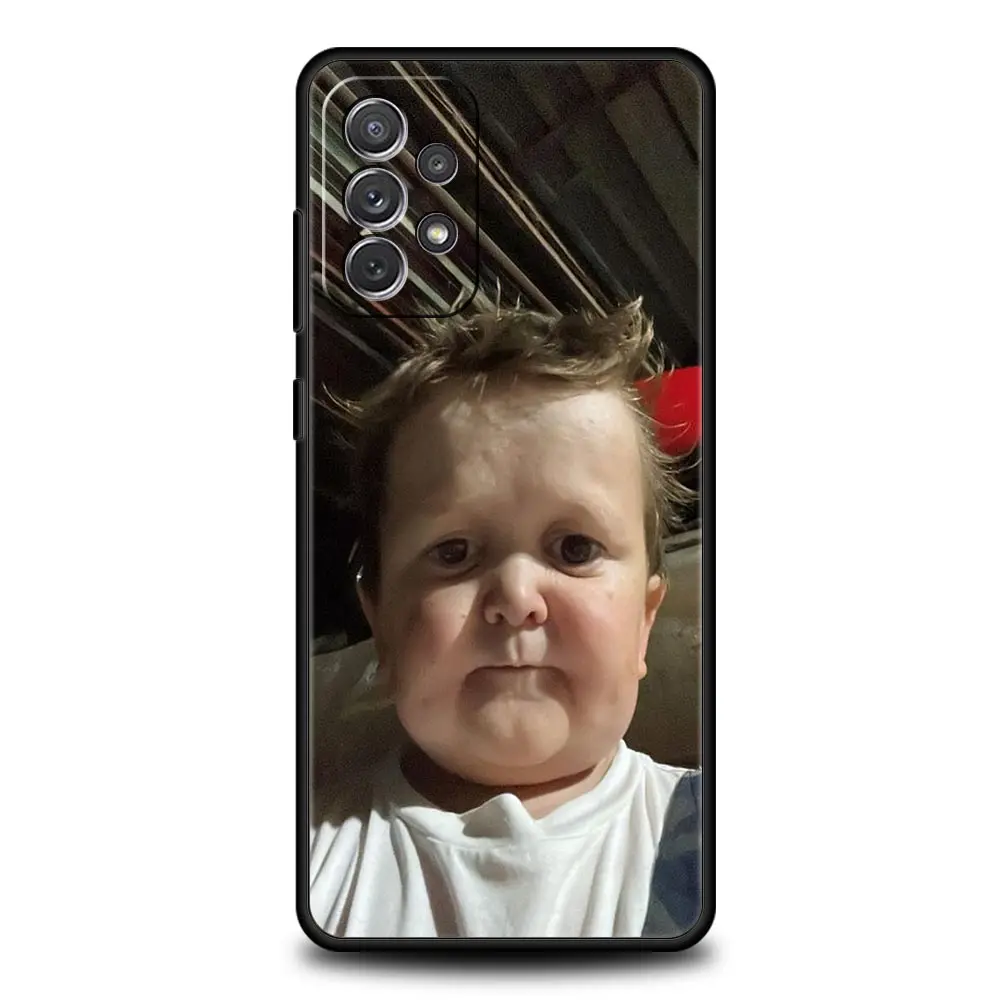 Funny Hasbulla Cartoon Design Soft Phone Case Cover