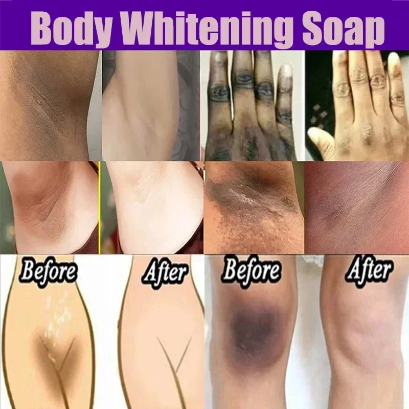Body Whitening lightening Soap Deep Clean Skin Chicken Skin Removal Soap Armpit Underarm Knees Bleaching Body Brighten White 3