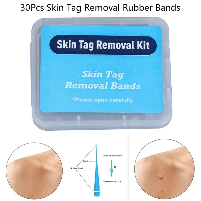 30pcs/pack Skin Tag Removal Rubber Bands Micro Band Non Toxic Face Care Mole Wart Skin Care Tools skin tag remover