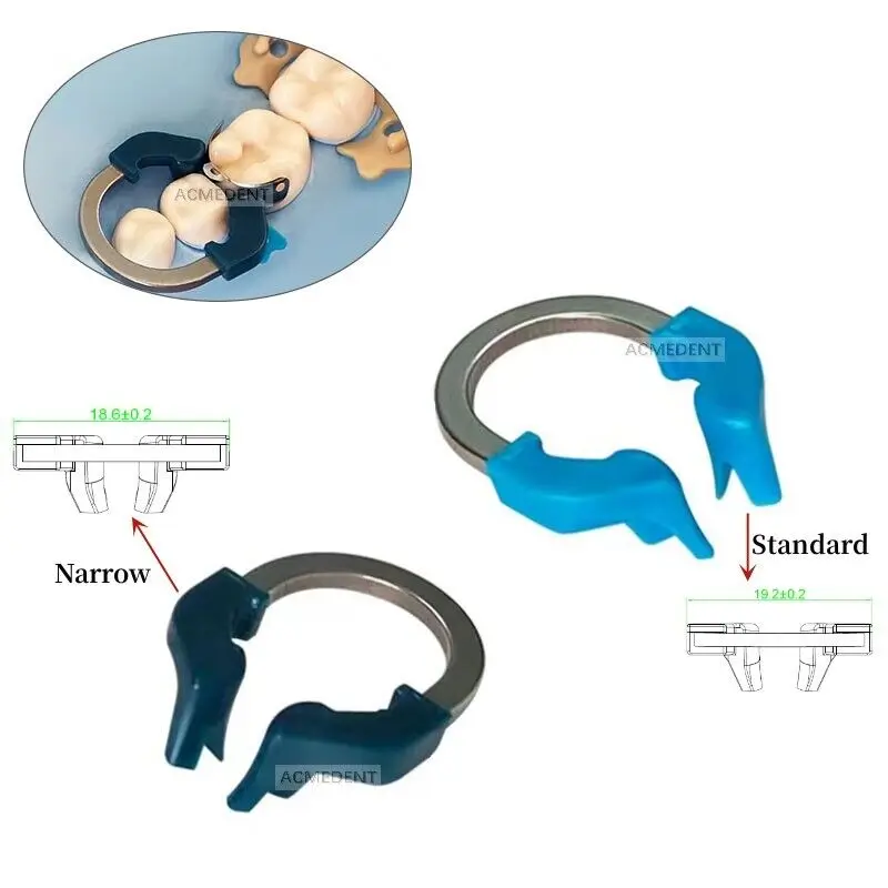 

Dental Sectional Matrix System Sectional Contoured Metal Matrix Bands Nickel Titanium Universal/Narrow Clamps Dental Materials