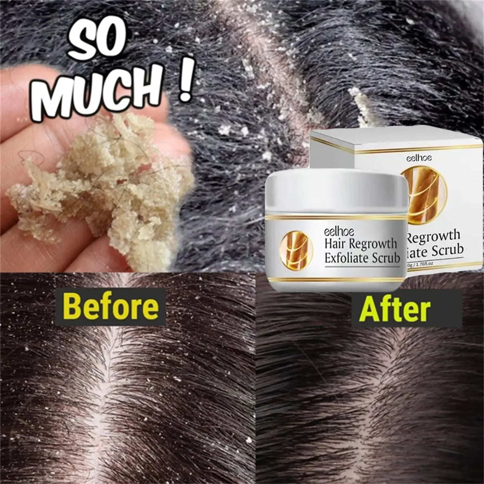 Fast Anti Dandruff Hair Treatment Scrub Itching Repair Scalp Cleaning Exfoliating Oil Control Antipruritic Hair Care Products pet anti flea drops mites insect repellent for formula cats dogs flea removers flea lice killer spray anti itching care products