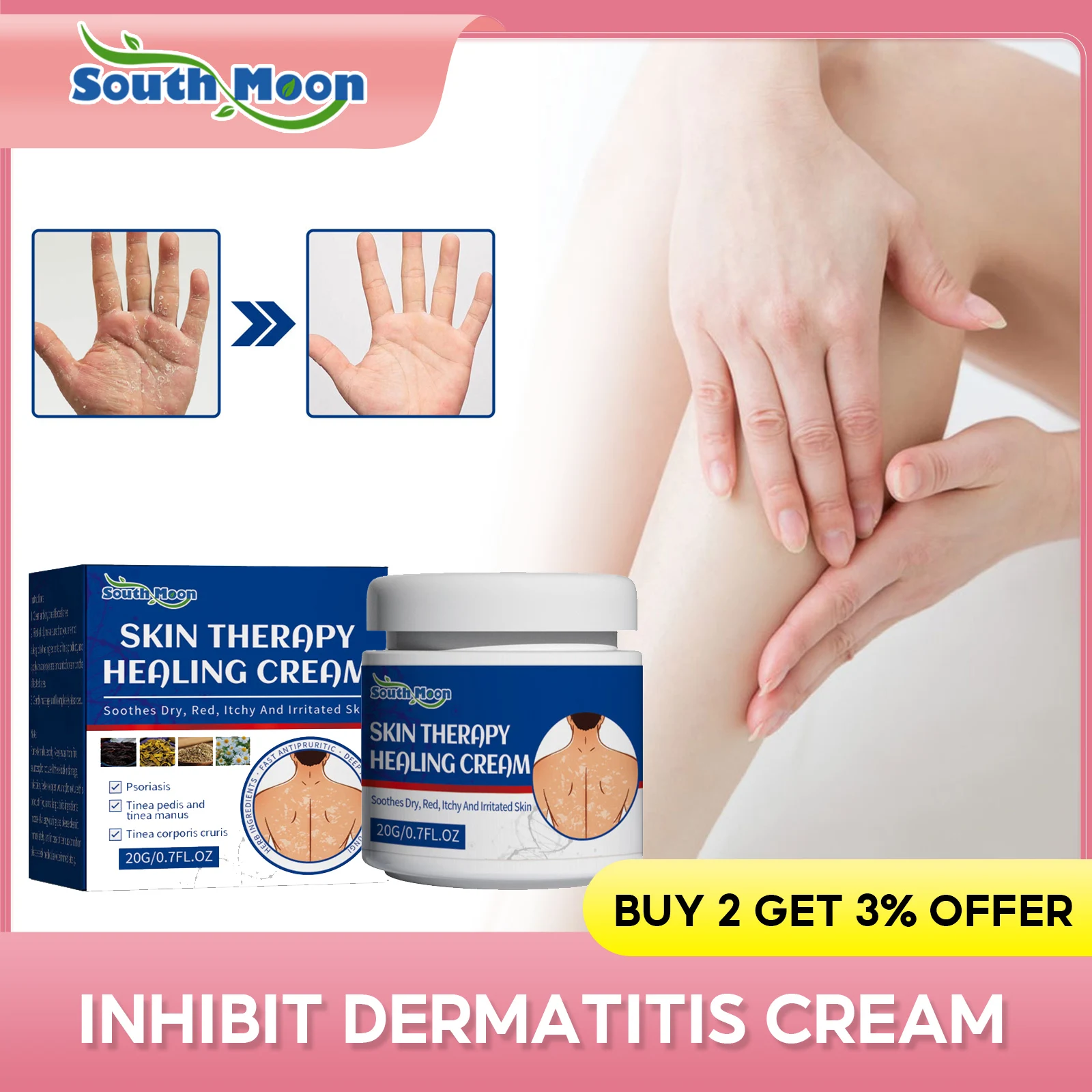 PsoriasisInhibitionCreamDermatitisPrivatePartsAntiItchingRed