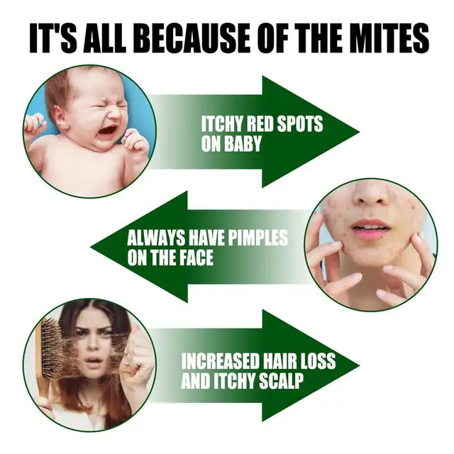 100Ml Dustmite Killing Spray Bed Hugs Remover Mitess Killer Természetes Ágybogárok Eliminátor Az Ágy Párnalap Kanapé Tisztítóhoz - Image 4