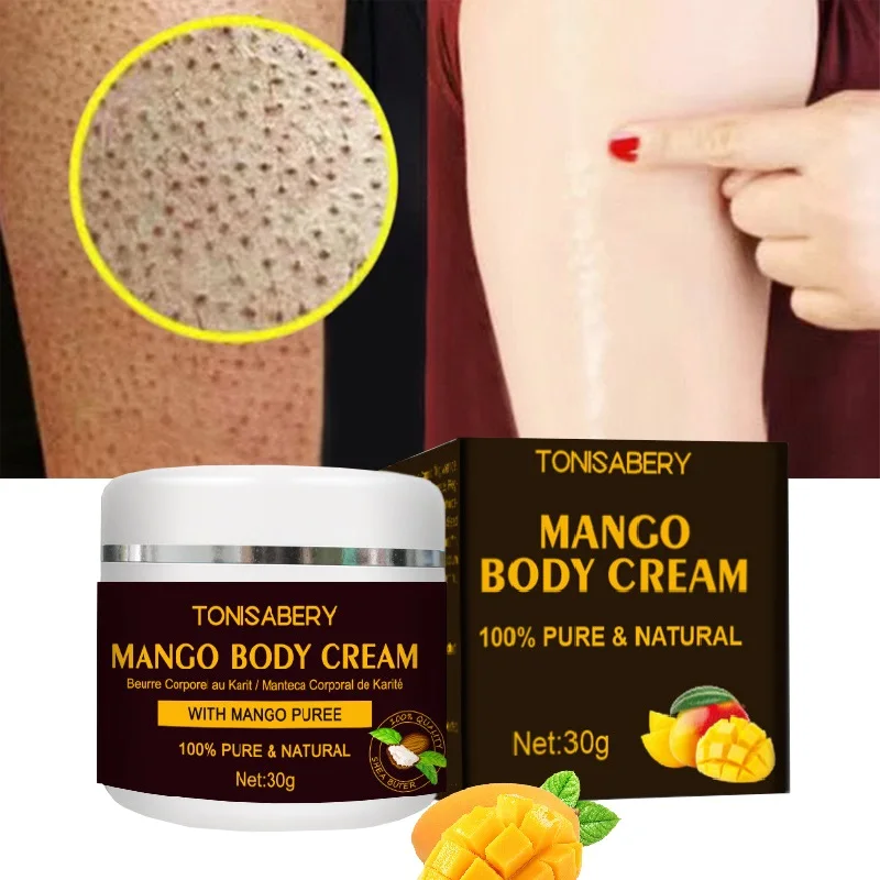 

Keratosis Pilaris Repair Treatment Cream Clearing Acne Spots Removal Chicken Skin Goose Bumps Deep Moisturizing Smooth Skin Care
