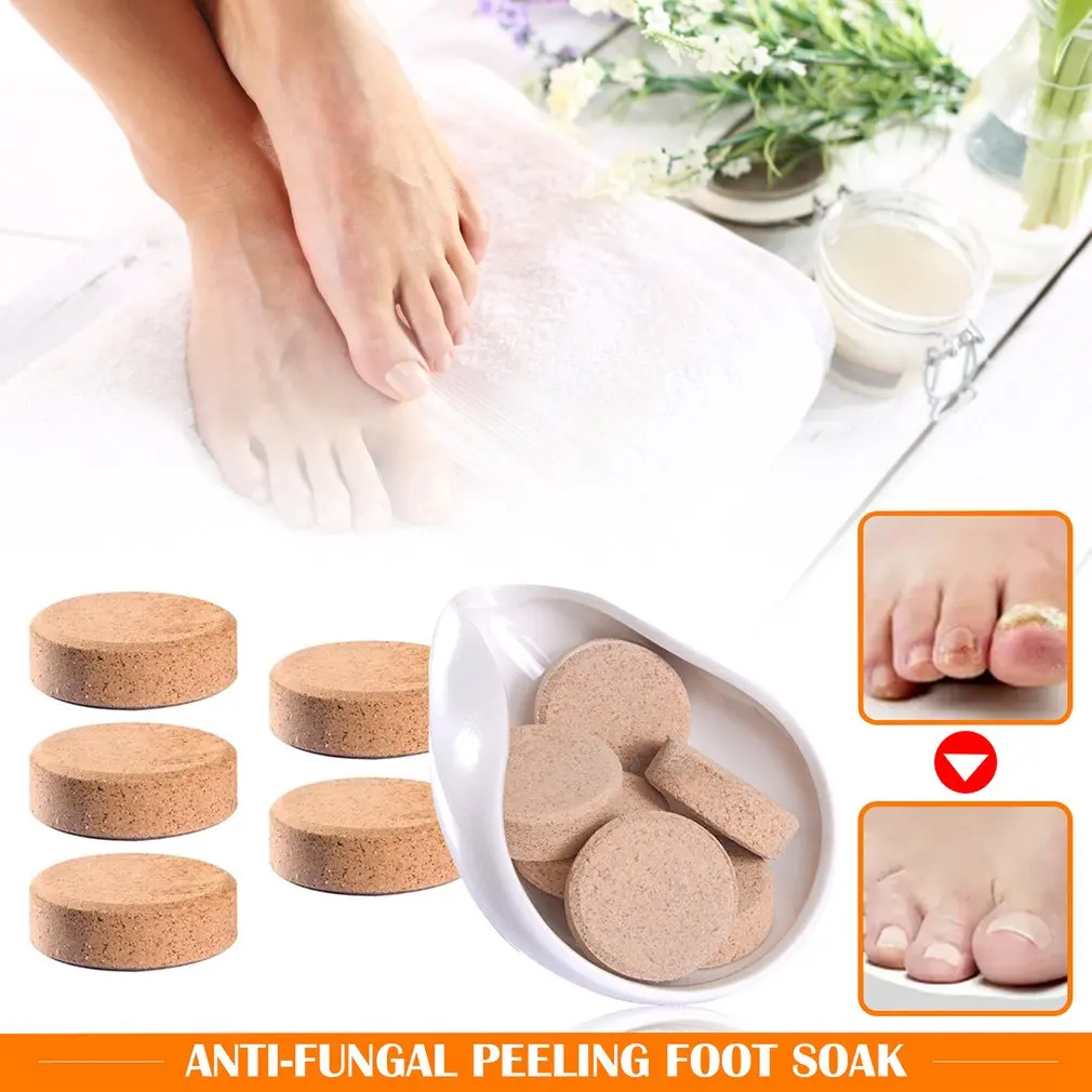 5pcs Foot Spa Ginger Soak Effervescent Tablets Antifungal Paeeling
