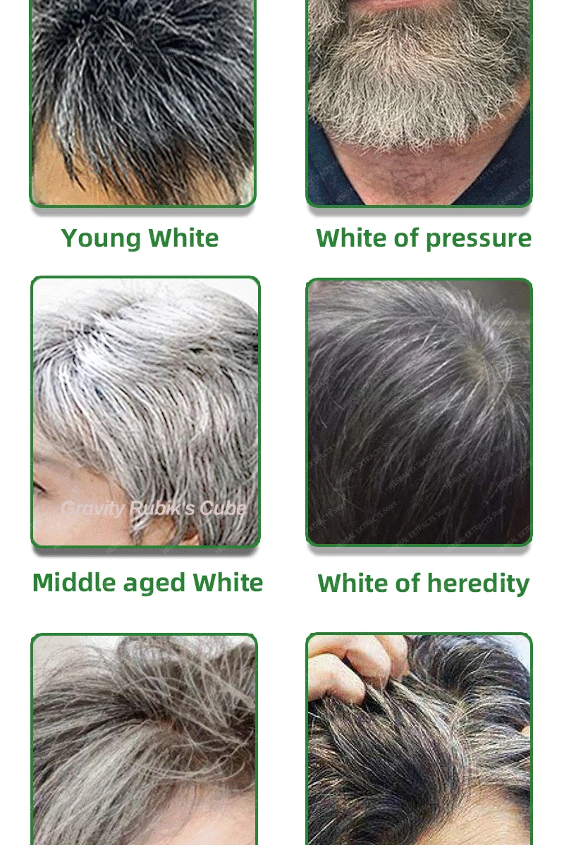 Description Picture 4 of itemAnti-Gray Hair Serum Gray Hair Treatment White Darkening