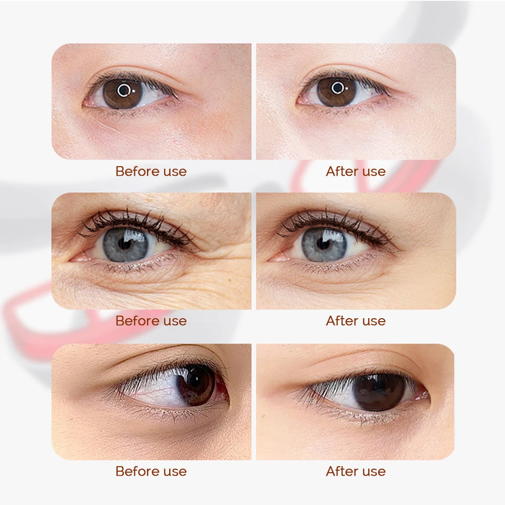 Red Light Electric Eye Massager Hot Compress Relieves Eye Fatigue Eyes Massage Glasses Eye Glasses Massager Dark Circles Remover