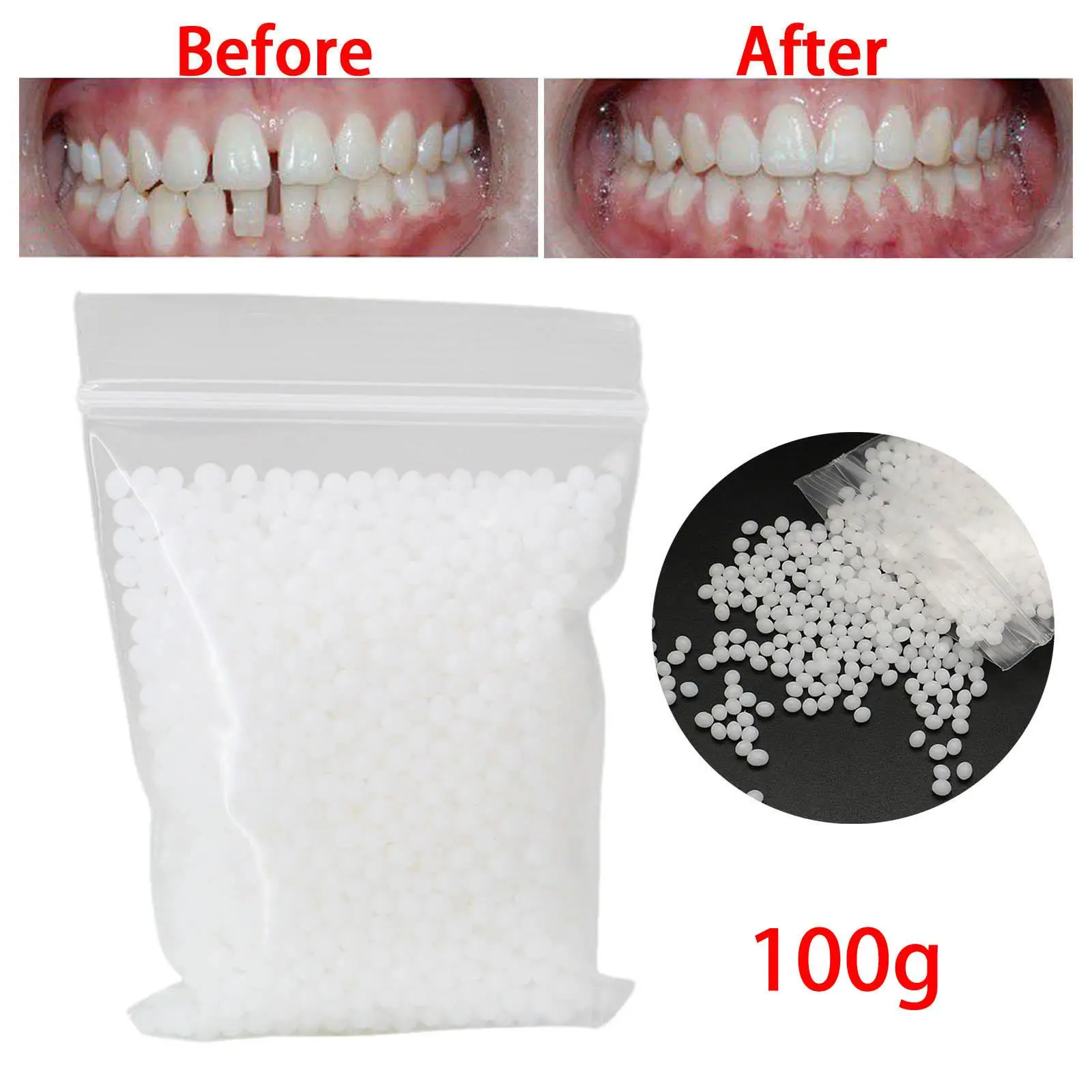 100G Temporary Tooth Repair Kit Solid Glue Gaps Denture Adhesive for