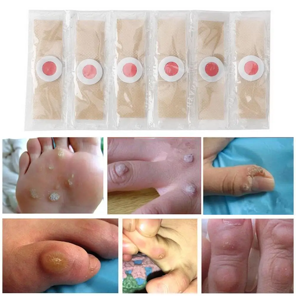 Foot Corn Remover Stickers 6PCS Foot Corn Remover Stickers Painless Medical Plaster Warts Thorn Feet Callus Chicken Eye Treatment Sticker Feet Care