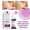 AHA 30% + BHA 2% Exfoliating Face Peel Serum – Gentle Chemical Exfoliator for Dark Spots, Pore Minimizing & Skin Renewal 1