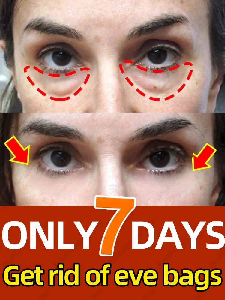 Eye Bags Remover Instant Remove Eye bags Dark Circles Eyes Wrinkle Fine Line