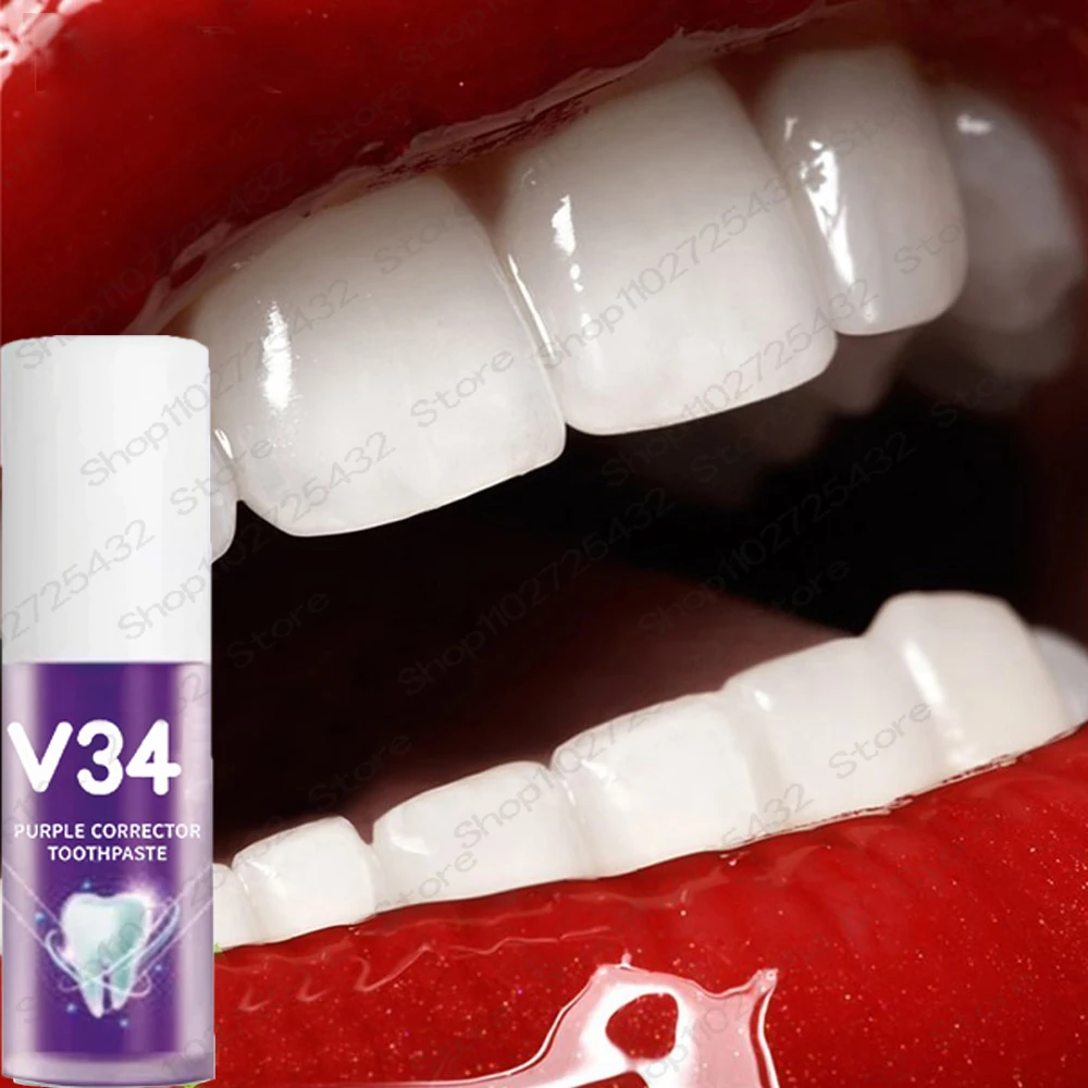 Mousse de soin dentaire, Essence, élimine la Plaque dentaire, réparation gingivale, prévention des caries, nettoyage buccal, 30m_voghion.com