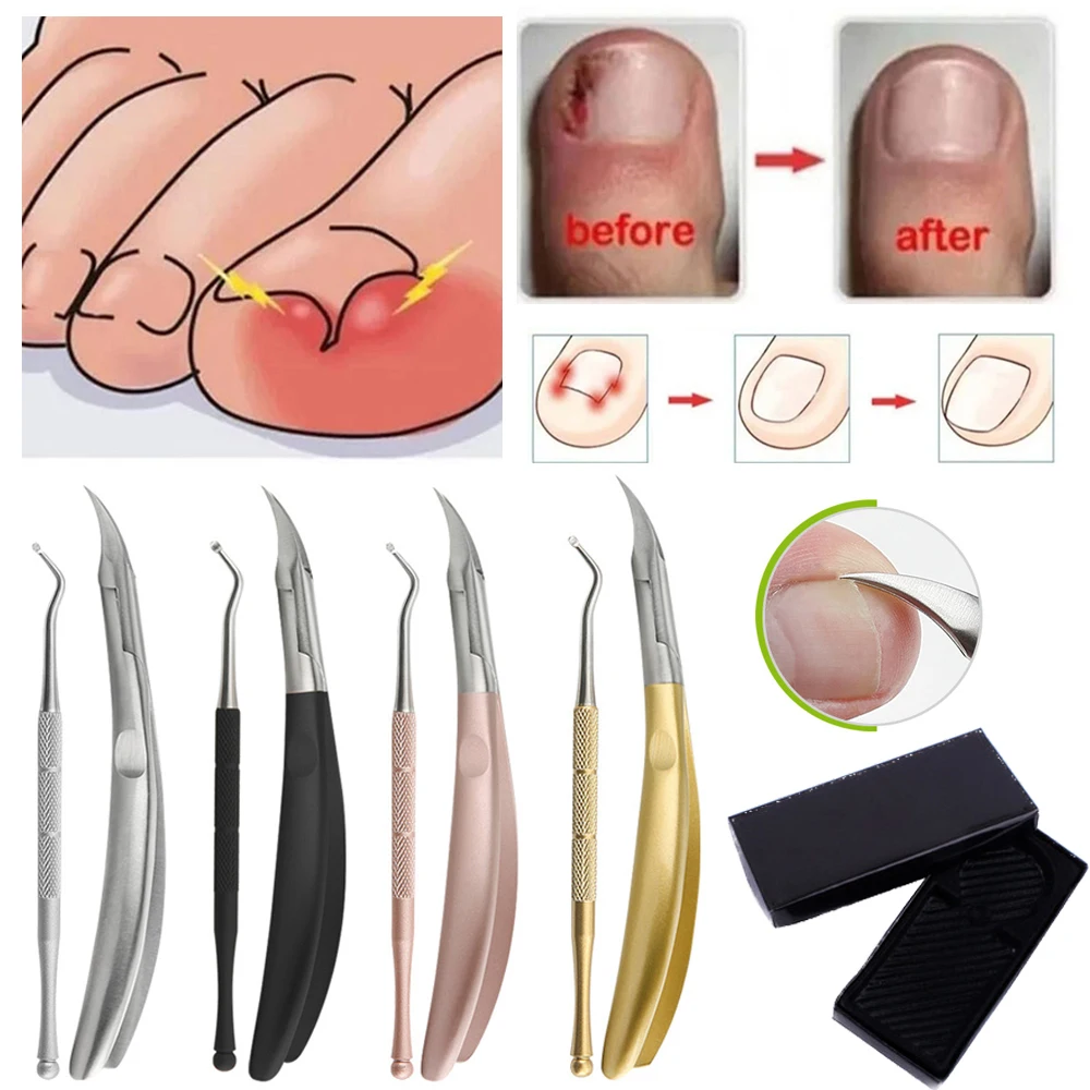 

2Pcs Paronychia Tool Set Nail Ingrown Nipper Cuticle Scissors Nail Cutter Remove Dead Skin Pedicure Tool Toenail Clippers