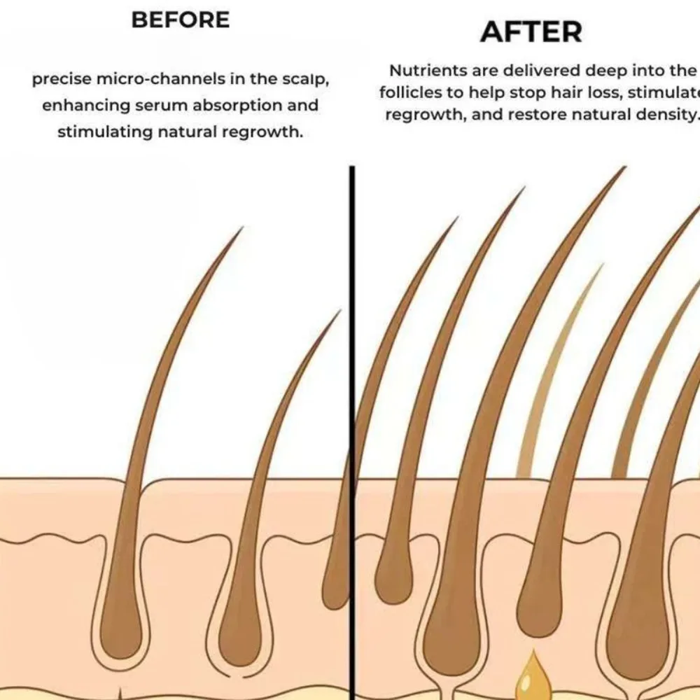 Hair Serum Gentle Nourishes the Scalp and Cares for the Softening Hair Care Daily Care Scalp Serum. - 4
