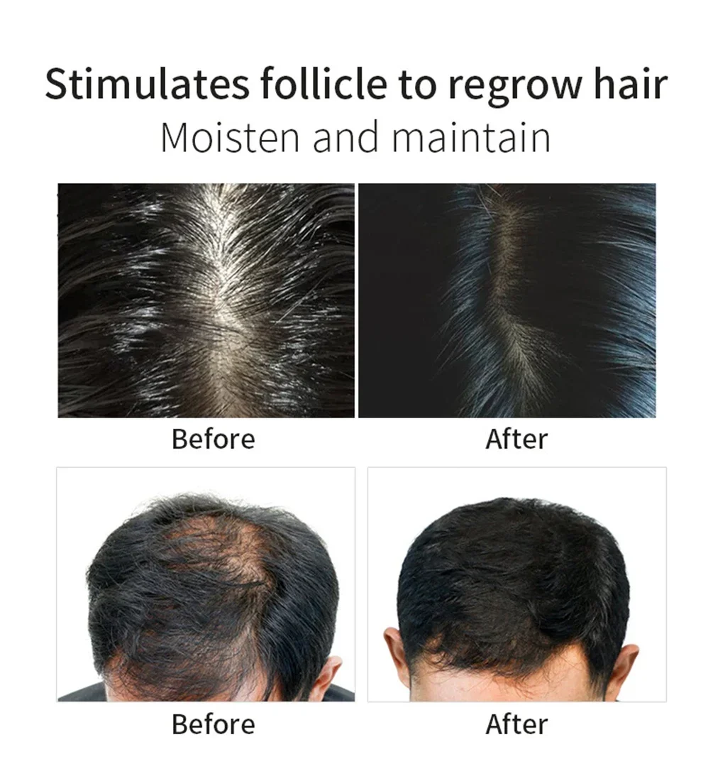 30ml Private Label Hair Growth Serum Custom Logo Hairs Root Grow Nutrient Solution Prevention Hair-loss Essential Oil Makeup 6