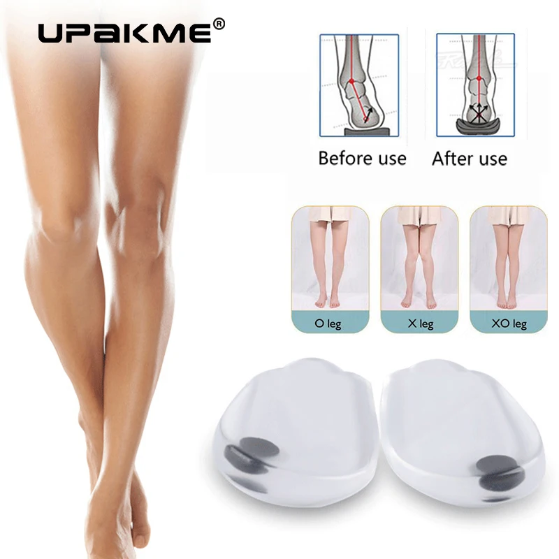2PCS Insoles Correction Shoes Inserts Pads Effective O/X Type Leg Bowed