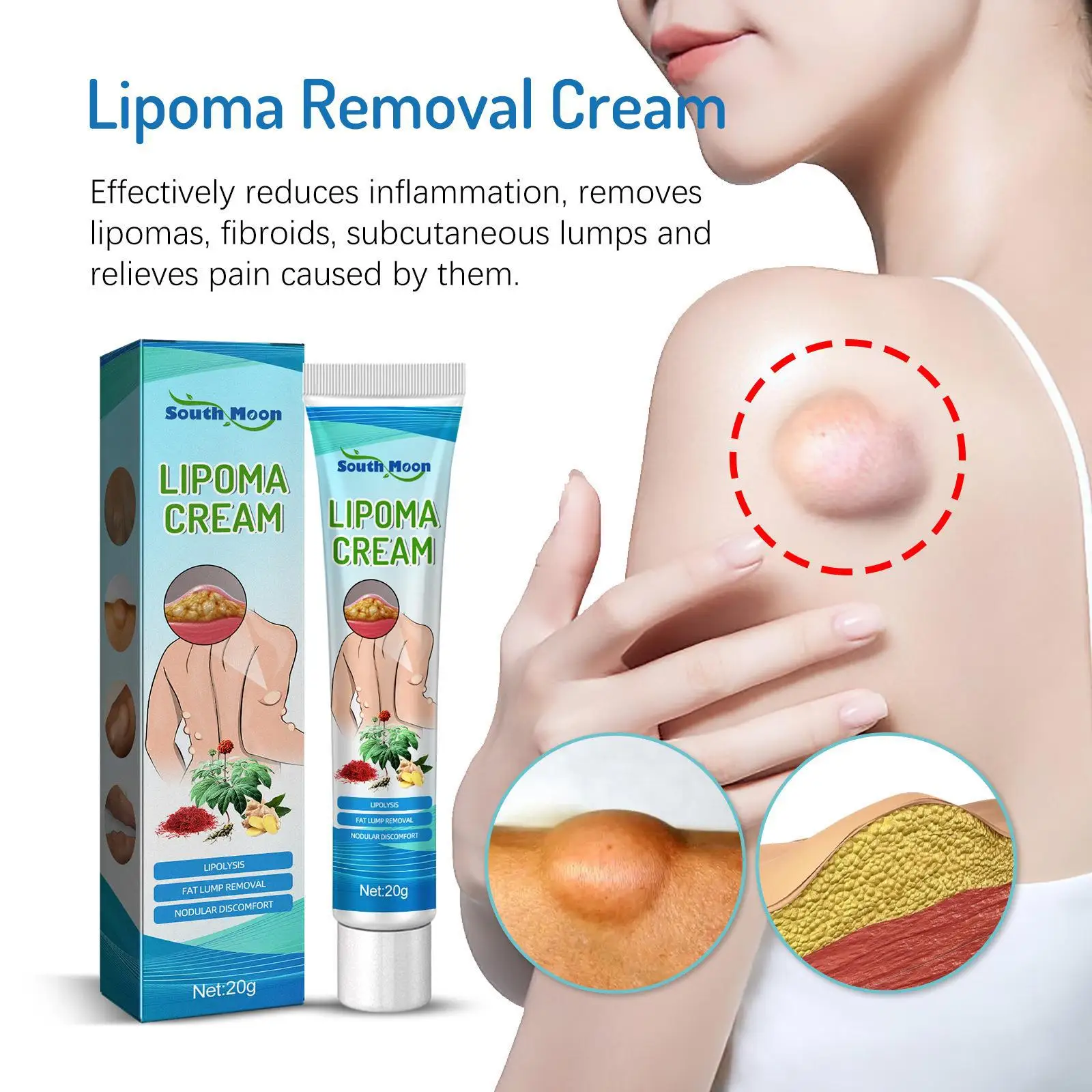 

20g Lipoma Removal Cream Relief Pain Treat Skin Swelling Lipolysis Cellulite Fat Lump Nodule Removal Ointment Anti-tumor Plaster