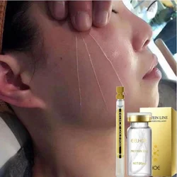 Collagen Line Soluble Protein Line Essence Kit Absorbable Facial Fillers Anti-aging Skin Care Instant Lifting Wrinkle Remover