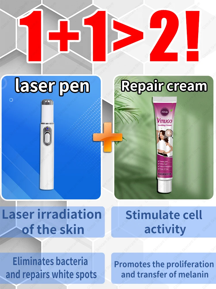 Improve vitiligo laser laser treatment