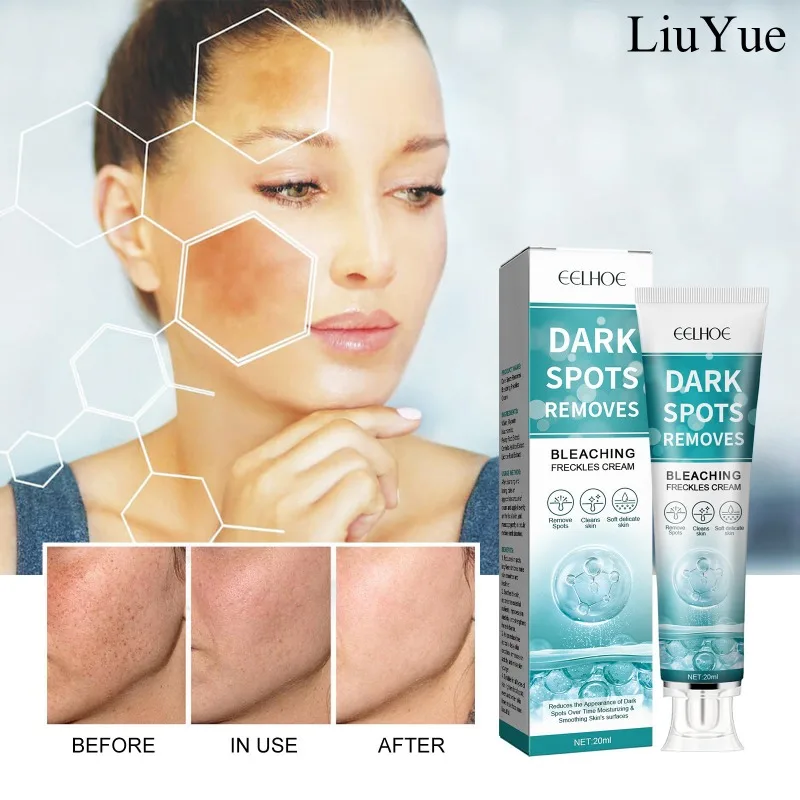 Lighten Melanin Whitening Cream Women Face Quick Remove Spots Cream Niacinamide Brighten Dark Skin Care Fade Dull Whiten Product