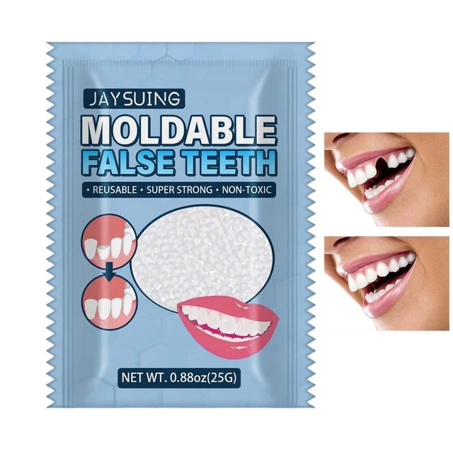 Tooth Repair Granules, Moldable False Teeth Thermal Beads, Temporary Tooth  Replacement Kit, Temporary Tooth Repair Kit, Cavity Filler for Teeth,  Moldable False Teeth (2Pcs) : : Health & Personal Care