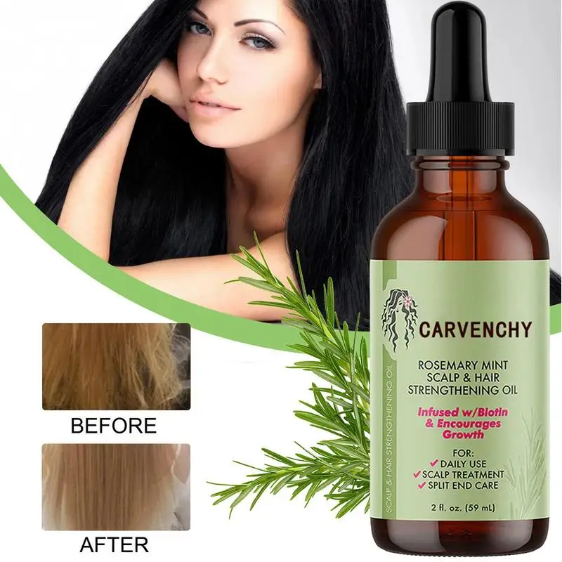 

Rosemary Oil For Hairs Hair Oil Applicator Crece Pelo Hombre Hair Growth EssentialOil Karsell Collagen Hair Hair Nourishing Oil