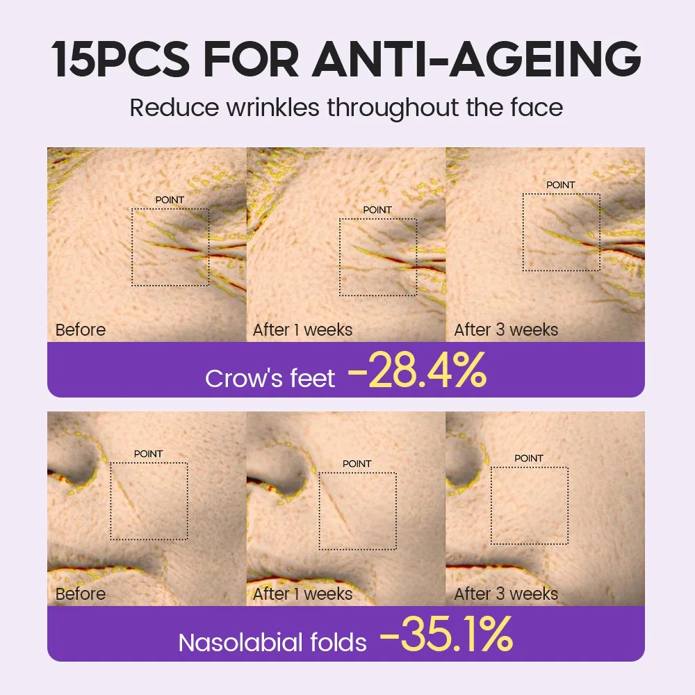 Retinol + Pro-xylane Ampoule serum  Repairs Strengthens The Skin And Diminishes Fine Lines Face Beauty Skin Care 15pcs 3