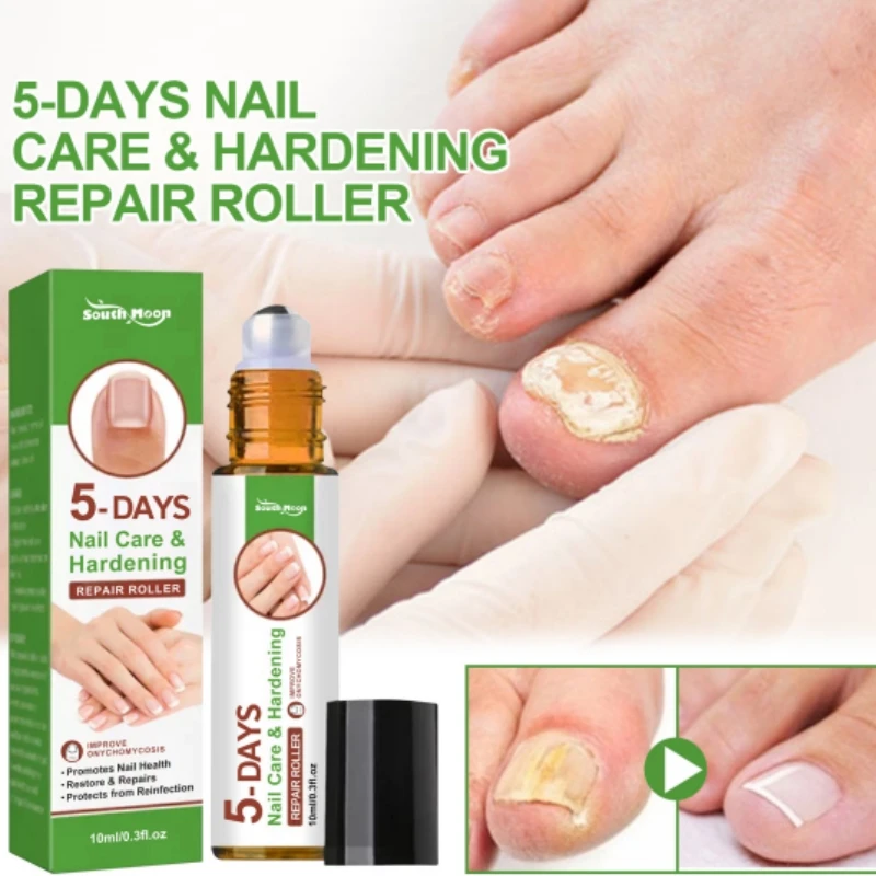 In just 5 Days Grow Long & Strong Nails Fast At Home | Super fast Nails  Growth Tips - YouTube | How to grow nails, Fast nail, Nail growth tips