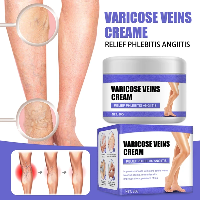 Varicose Veins Cream For Legs Tightens Skin Hydraing Personal Care Skin