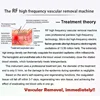 High Frequency Red Blood Vessel Spots Vascular Removal Spider Veins Remover Beauty Equipment Anti Redness Machine 5