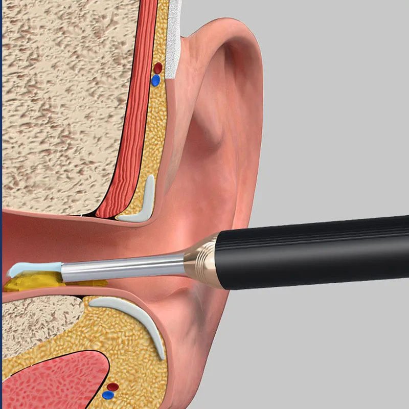 Intelligent Wireless Visual Ear Picking Soft And Painless Safe No Dead Angle Ear Picking For Adult Children Ear Cleaning Tools 4