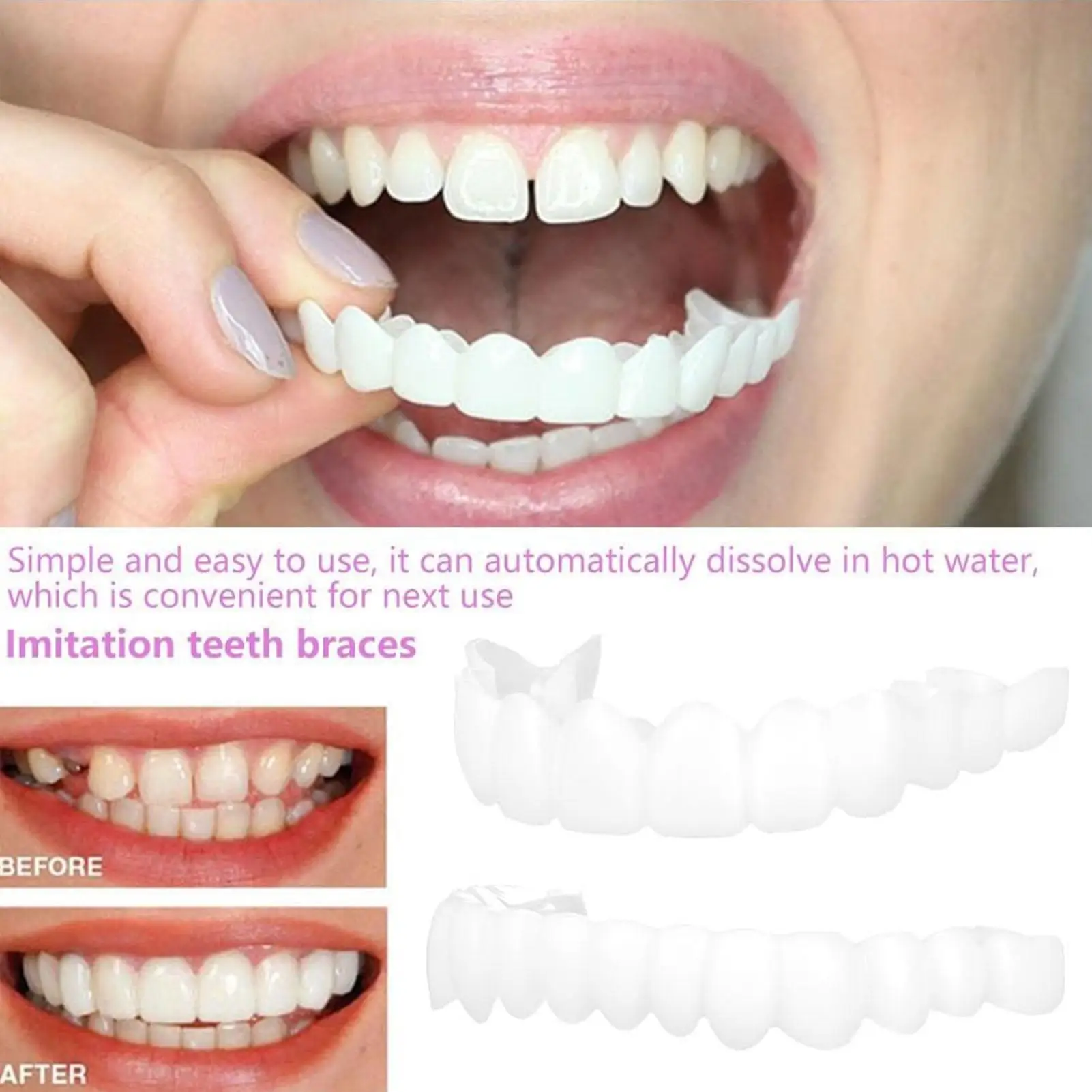 Tooth Veneers Unisex Teeth Veneer Upper Lower Veneers Temporary Smile Improver Instant Confidence Smile Tools Beauty Tool