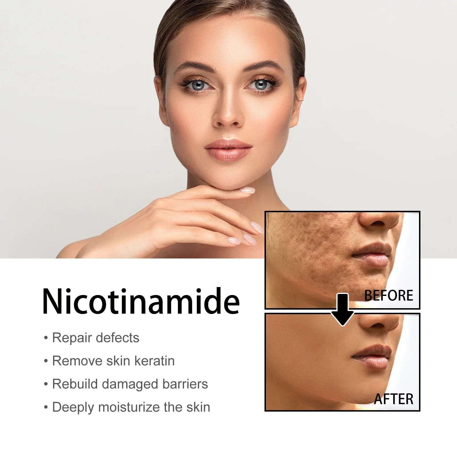 Niacinamide Serum for Acne and Dark Spots - Hyaluronic Acid Anti Aging Face Serum Pore Shrinking Hydrating Moisturizing 50ml 4