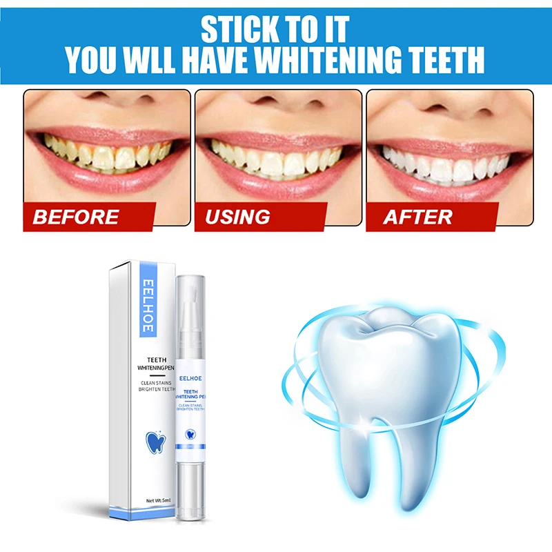 Effective Teeth Whitening Pen1