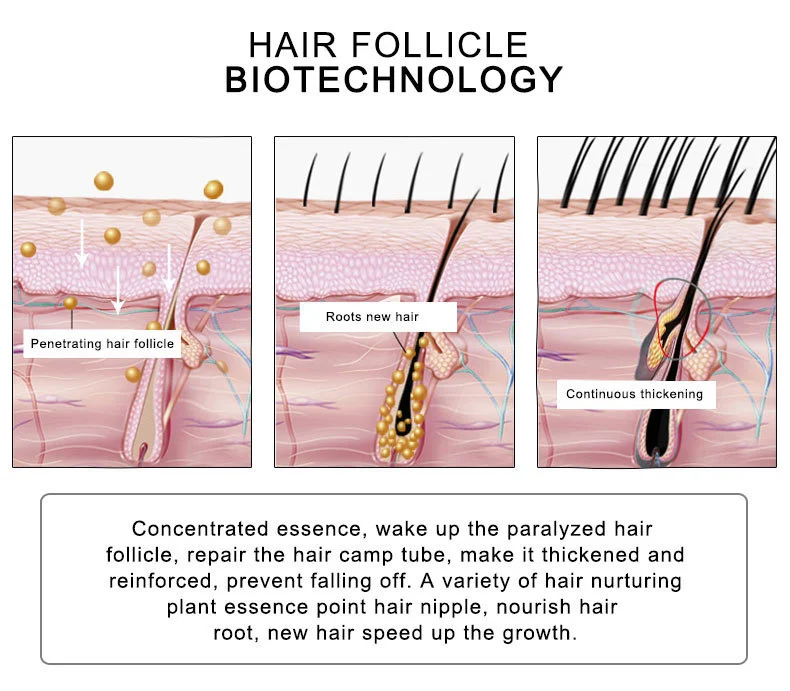 Description Picture 5 of itemARTISCARE Hair Loss Growth Spray Hair Oil Keratin Hair treatment Prevent hair Promote hair growth Nouish the scalp Thick Hair