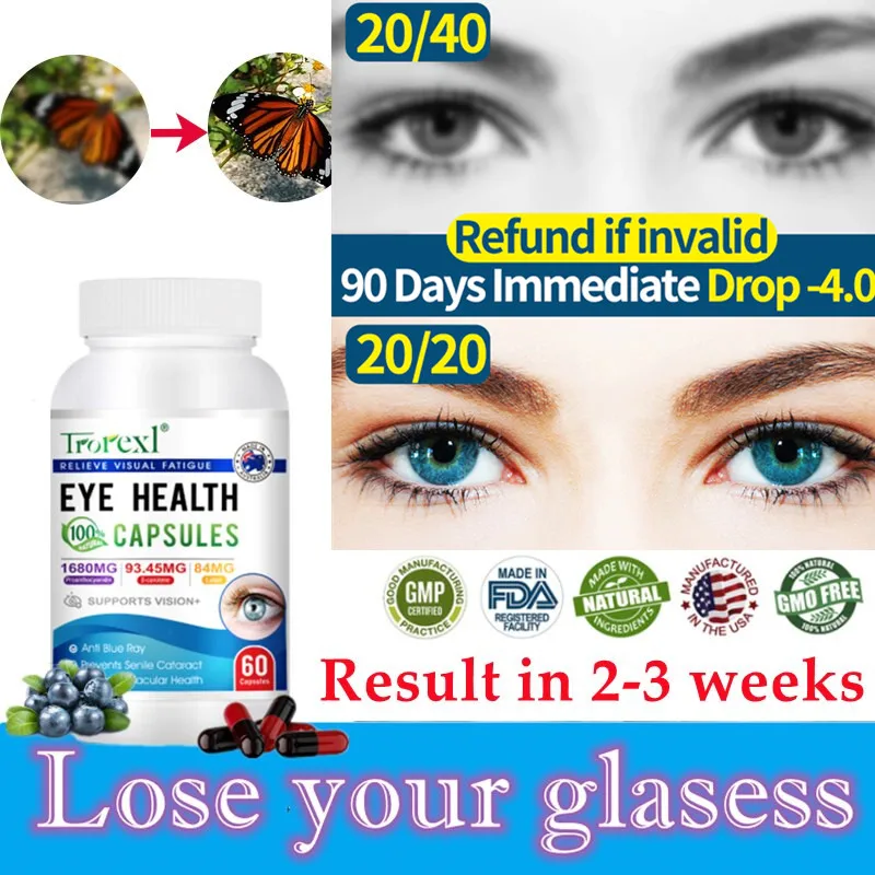 Health Supplement Eye Vitamins High Potency Lutein Capsules-Relieve Eye Fatigue Dry Eye and Vision Health Prevent Blue Light Prevent Myopia
