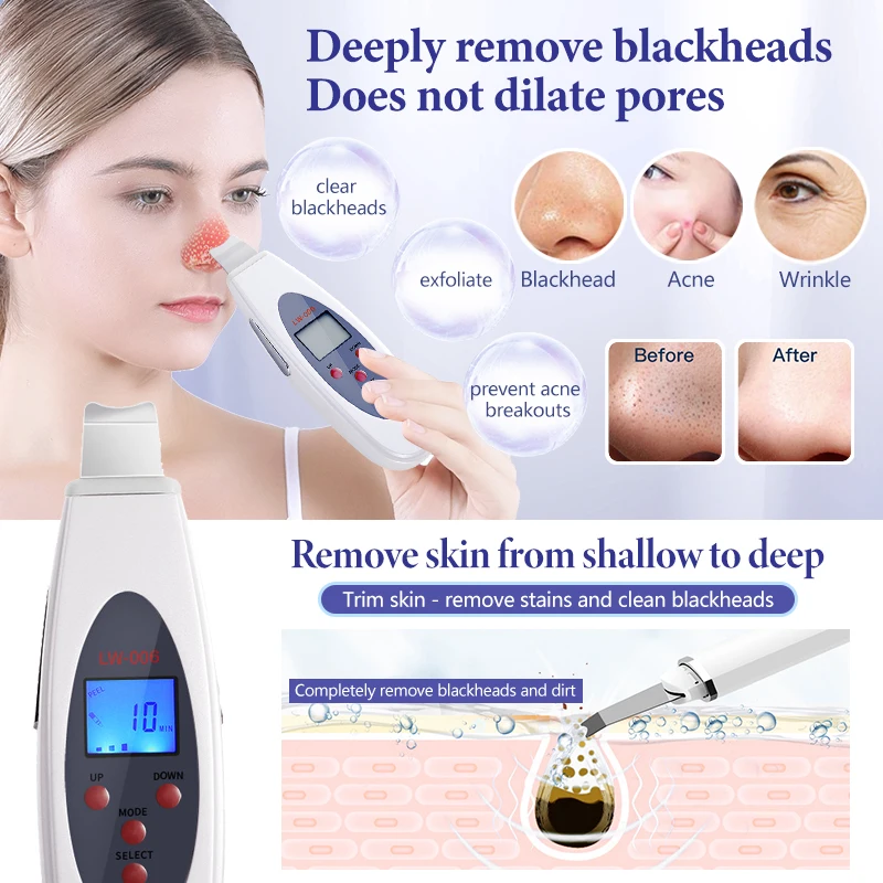 Facial Cleaner Facial Scrubber Ultrasonic Skin Scrubber Deep Face Cleaning Machine RemoveFacial Massager Ultrasound Peeling Clean Tone Lift LW006
