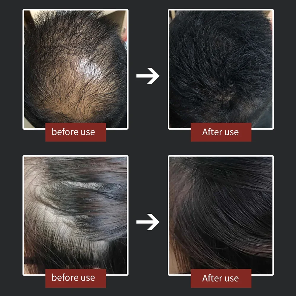 Hair Building Fibers 27.5g Authentic Keratin Fiber Natural Powder Men Grow Spray Thickening Products